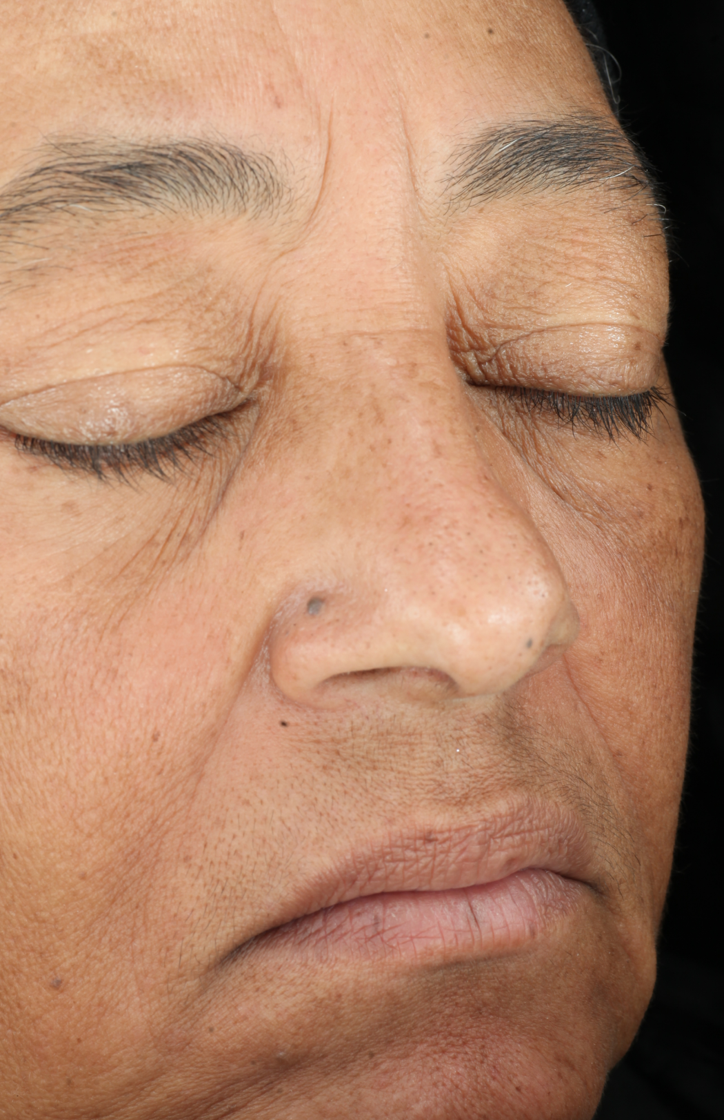 ZO Skin Health Growth Factor Serum clinical study results, subject 2 - after week 12