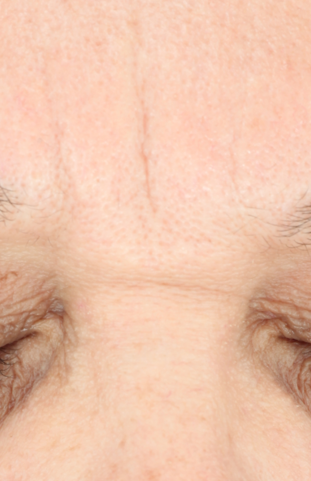 ZO Skin Health Growth Factor Serum clinical study results, subject 1 - after week 12