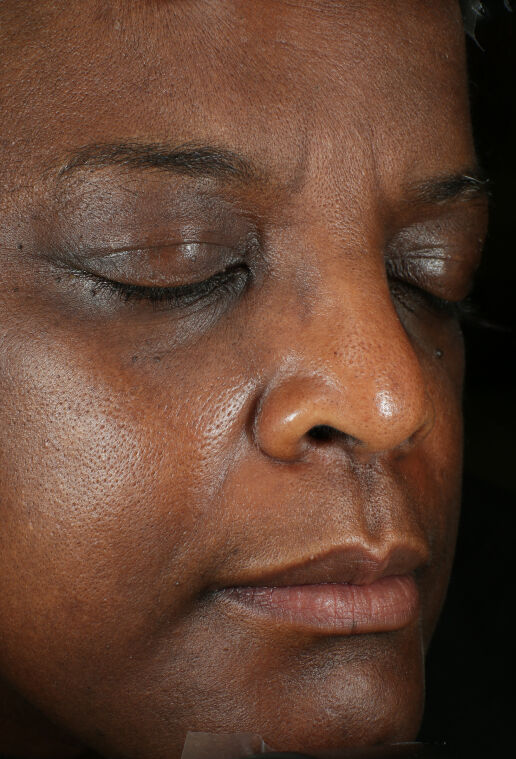 ZO Skin Health Brightalive Skin Brightener clinical study results, participant 1 - after week 15